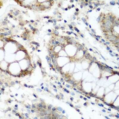 Immunohistochemistry-Paraffin: FLJ14154 Antibody - BSA Free [NBP3-03383]