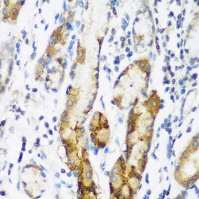 Immunohistochemistry-Paraffin: FLJ14154 Antibody - BSA Free [NBP3-03383]