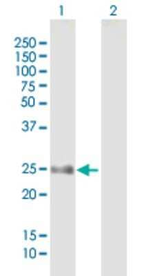 Western Blot: FLJ14154 Antibody [H00079903-B01P]