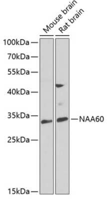 Western Blot: FLJ14154 AntibodyBSA Free [NBP3-03383]