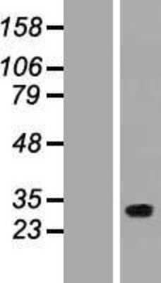 Western Blot: FLJ14154 Overexpression Lysate [NBP2-06274]