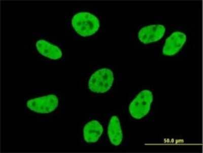 Immunocytochemistry/ Immunofluorescence: VPS50 Antibody (2D11) [H00055610-M01]
