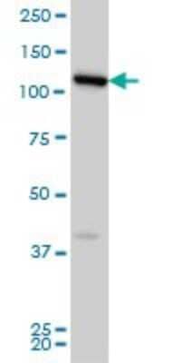Western Blot: VPS50 Antibody (2D11) [H00055610-M01]