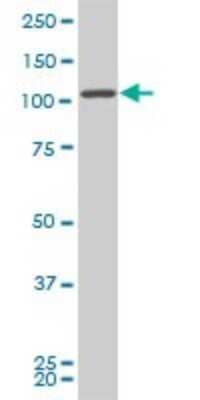 Western Blot: VPS50 Antibody (2D11) [H00055610-M01]