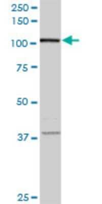 Western Blot: VPS50 Antibody (2D11) [H00055610-M01]