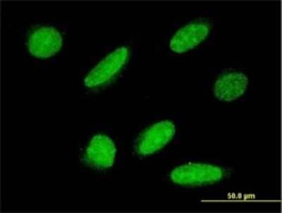 Immunocytochemistry/ Immunofluorescence: FLJ21908 Antibody (1F2) [H00079657-M01]