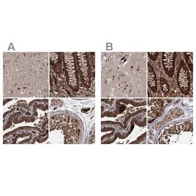 Immunohistochemistry-Paraffin: FLJ21908 Antibody [NBP1-89849]