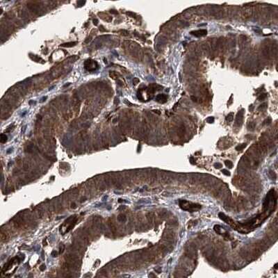 Immunohistochemistry-Paraffin: FLJ21908 Antibody [NBP1-89849]