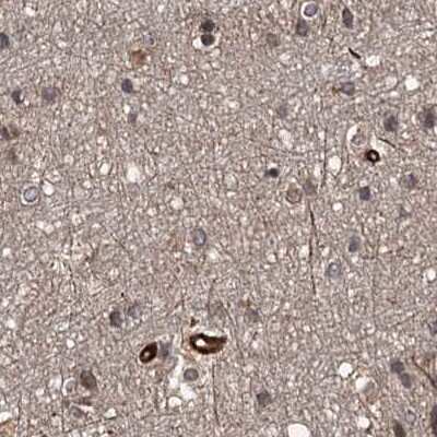Immunohistochemistry-Paraffin: FLJ21908 Antibody [NBP1-89849]