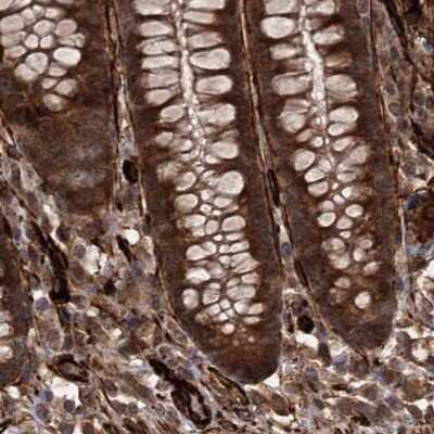 Immunohistochemistry-Paraffin: FLJ21908 Antibody [NBP1-89849]