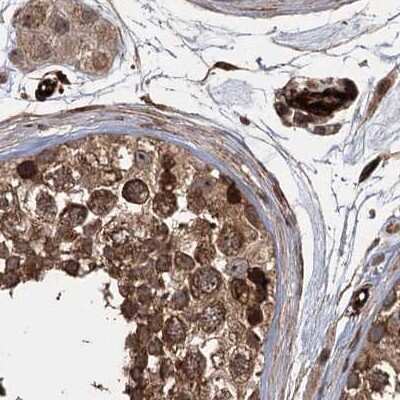Immunohistochemistry-Paraffin: FLJ21908 Antibody [NBP1-89849]
