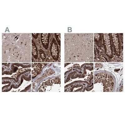 Immunohistochemistry-Paraffin: FLJ21908 Antibody [NBP1-89850]