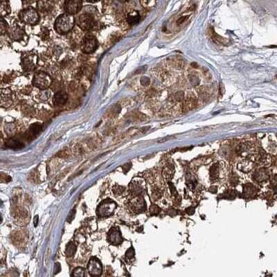 Immunohistochemistry-Paraffin: FLJ21908 Antibody [NBP1-89850]