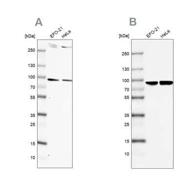 Western Blot: FLJ21908 Antibody [NBP1-89849]