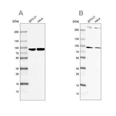 Western Blot: FLJ21908 Antibody [NBP1-89850]