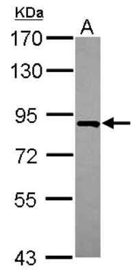 Western Blot: FLJ21908 Antibody [NBP2-16506]