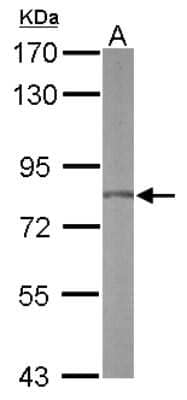 Western Blot: FLJ21908 Antibody [NBP2-16506]