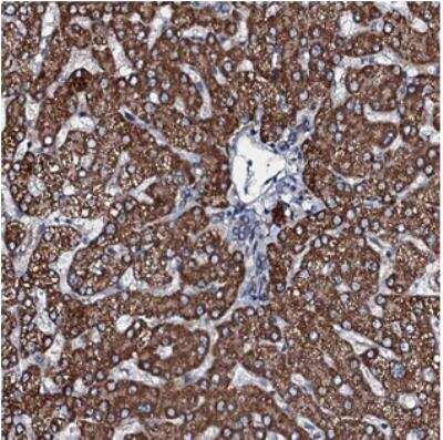 Immunohistochemistry-Paraffin: FLJ21963 Antibody [NBP2-30585]