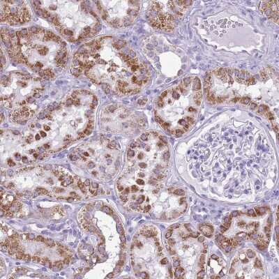 Immunohistochemistry: FLJ21963 Antibody [NBP2-48885]