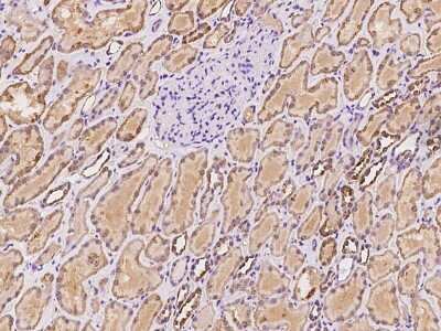 Immunohistochemistry-Paraffin: FLJ21963 Antibody [NBP2-98578]