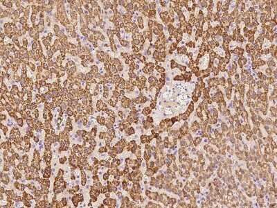 Immunohistochemistry-Paraffin: FLJ21963 Antibody [NBP2-98578]