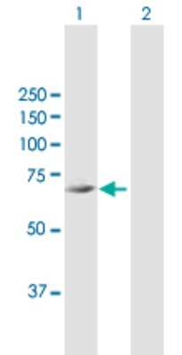 Western Blot: FLJ21963 Antibody [H00079611-B01P]