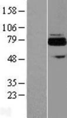 Western Blot: FLJ21963 Overexpression Lysate [NBL1-07271]