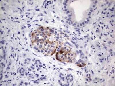 Immunohistochemistry: POMK/SGK196 Antibody (OTI2B10) [NBP2-45805]