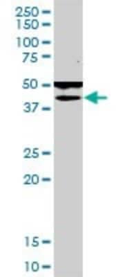 Western Blot: POMK/SGK196 Antibody (6F10) [H00084197-M03]