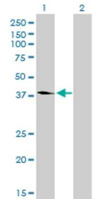 Western Blot: POMK/SGK196 Antibody (6F10) [H00084197-M03]