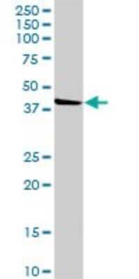 Western Blot: POMK/SGK196 Antibody [H00084197-D01P]