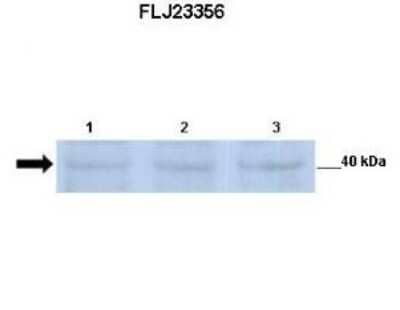 Western Blot: POMK/SGK196 Antibody [NBP1-59695]