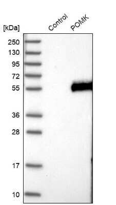 Western Blot: POMK/SGK196 Antibody [NBP2-13302]