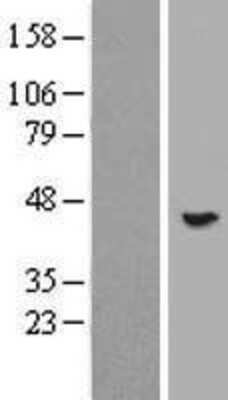 Western Blot: POMK/SGK196 Overexpression Lysate [NBP2-06056]