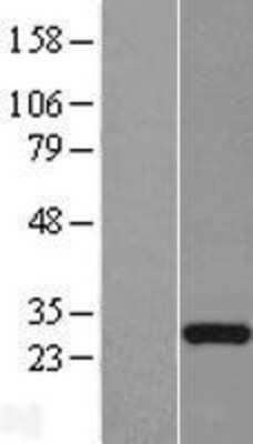 Western Blot: FLJ23584 Overexpression Lysate [NBL1-10760]