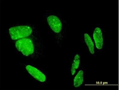 Immunocytochemistry/ Immunofluorescence: FLJ23834 Antibody (8E8) [H00222256-M03]