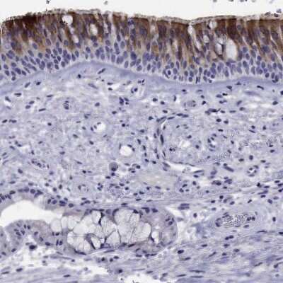 Immunohistochemistry-Paraffin: FLJ23834 Antibody [NBP1-88100]