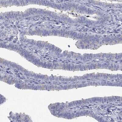 Immunohistochemistry-Paraffin: FLJ23834 Antibody [NBP1-88100]