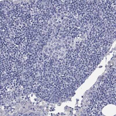 Immunohistochemistry-Paraffin: FLJ23834 Antibody [NBP1-88100]