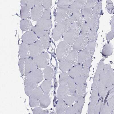 Immunohistochemistry-Paraffin: FLJ23834 Antibody [NBP1-88100]