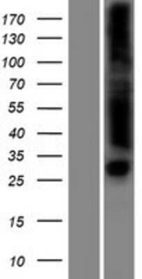 Western Blot: FLJ35220 Overexpression Lysate [NBP2-05124]