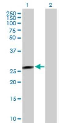 Western Blot: FLJ37201 Antibody [H00283011-B01P]