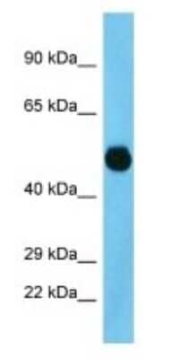 Western Blot: FLJ40125 Antibody [NBP3-09304]