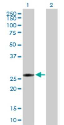 Western Blot: FLJ40504 Antibody [H00284085-B01P]