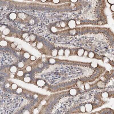 Immunohistochemistry-Paraffin: FLJ46536 Antibody [NBP1-91908]