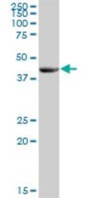 Western Blot: FLJ46536 Antibody [H00285180-B01P]