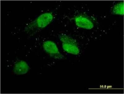 Immunocytochemistry/ Immunofluorescence: FLJ98241 Antibody (3A2) [H00220594-M03]