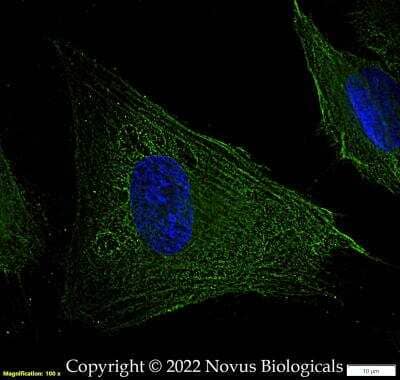 Immunocytochemistry/ Immunofluorescence: FLNC Antibody - BSA Free [NBP2-79816]