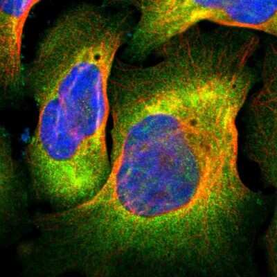 Immunocytochemistry/ Immunofluorescence: FLNC Antibody [NBP1-89300]