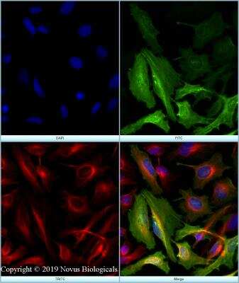 Immunocytochemistry/ Immunofluorescence: FLNC Antibody - BSA Free [NBP2-79816]